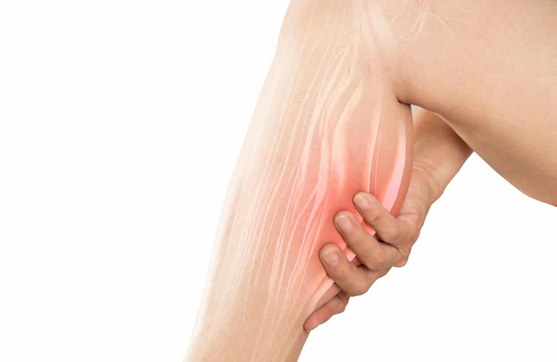 Mỏi cơ bắp chân: Nguyên nhân, triệu chứng và cách điều trị